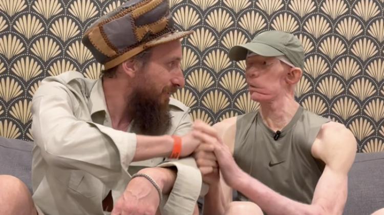 Yellowman dans L'Interview de Judah